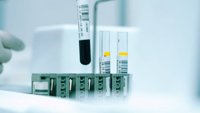 Test tube with liquid